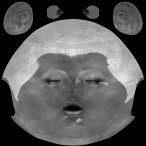 extracted_MR_BC_Head_R.jpg